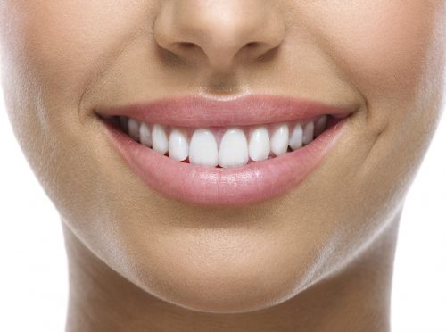Brooklyn Braces